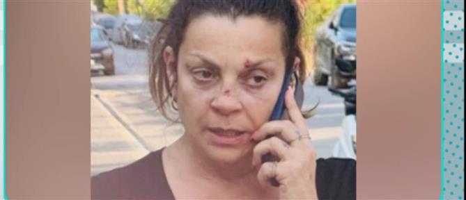 Πρώην σύζυγος Στάθη Αγγελόπουλου στον ΑΝΤ1 : "Δεν θέλω να τον ξαναδώ μπροστά μου" (βίντεο)