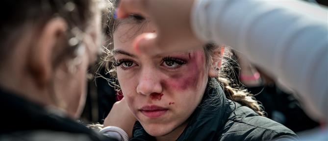 Πάτρα: Ανήλικες επιτέθηκαν σε 14χρονη - Τη χτύπησαν στο πρόσωπο