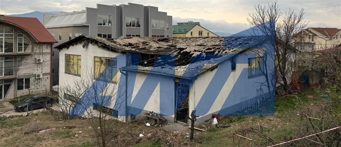 Βόρεια Μακεδονία - Φωτιά σε κλαμπ: Εξιτήριο έπειτα από 2 μήνες για εγκαυματία