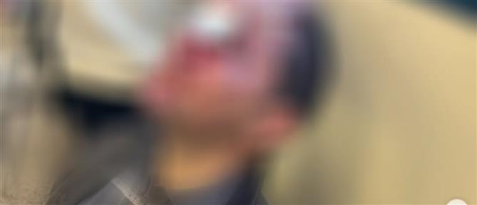 Νομική Αθηνών: Προσαγωγές για το βίαιο περιστατικό από ομάδα κουκουλοφόρων